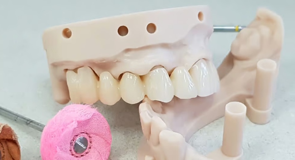 深圳牙科修复用3D打印技术怎么实现？