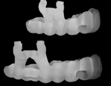 3D打印生物牙髓选什么技术？光固化数字光处理，微米级精准成型！